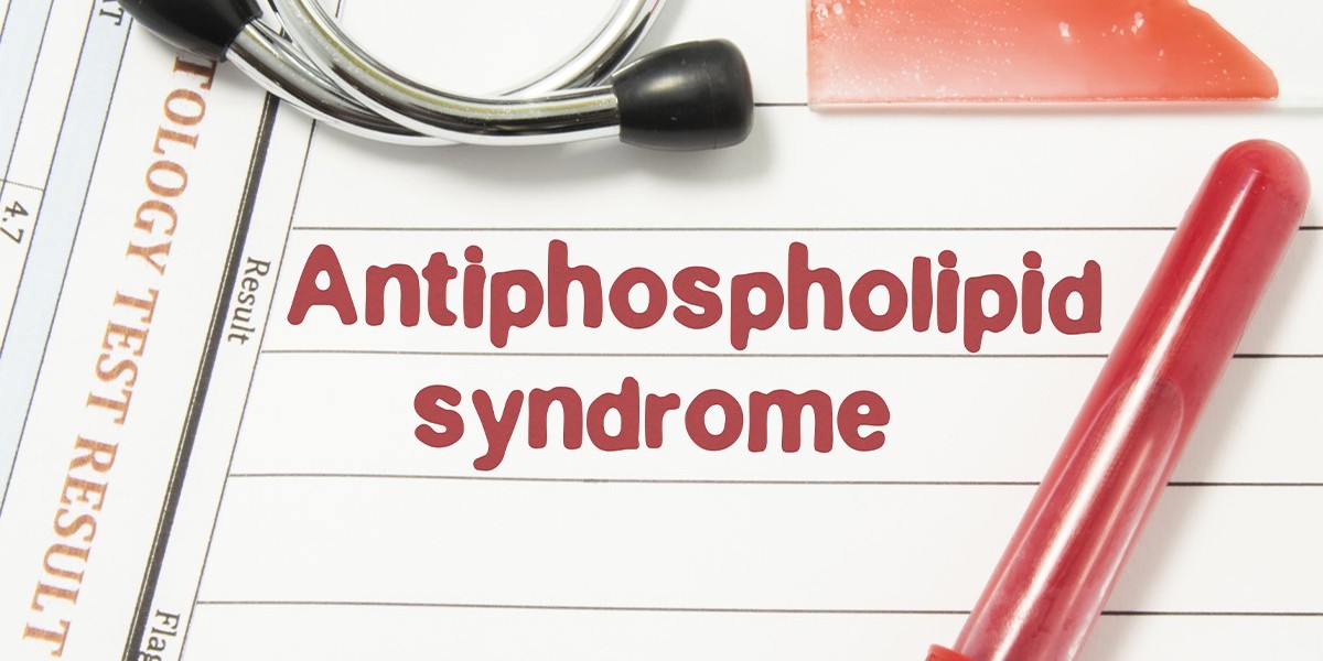 Private APS Blood Test: Understanding Its Importance and Process