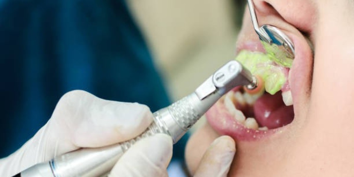 Pain-Free Teeth Cleaning in Riyadh – Safe & Effective