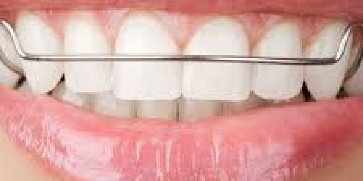 Orthodontic Retainers Market Potential Driven by Innovation, Digital Dentistry, and Rising Aesthetic Dental Demands