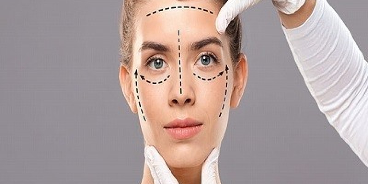 Facial Fat Grafting with a Facelift: A Game-Changer?
