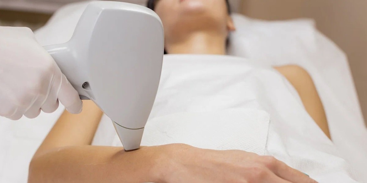 Is Laser Hair Removal Permanent? Riyadh Specialists Answer