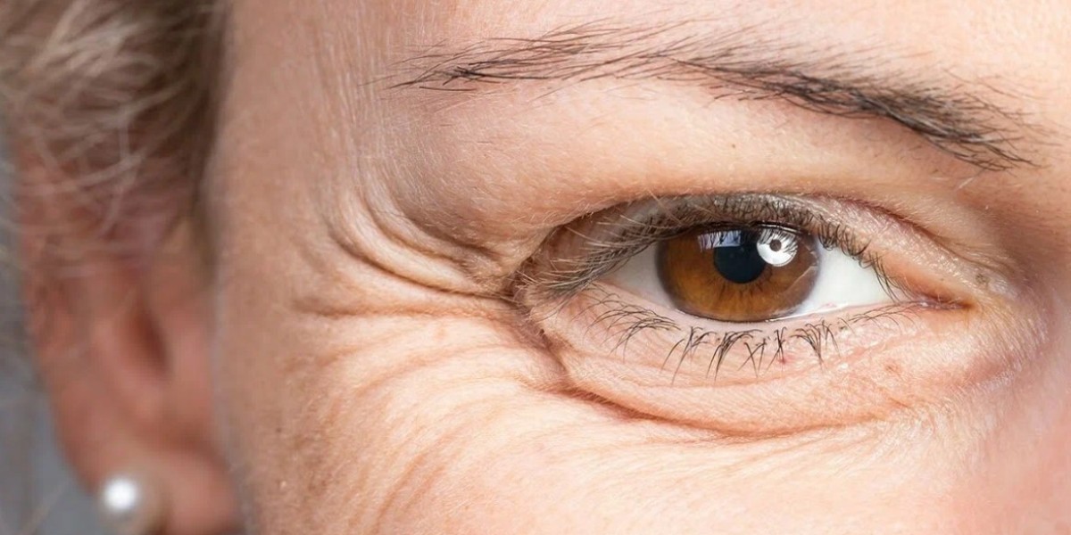Fine Line Solutions in Riyadh for Men Who Care About Their Skin