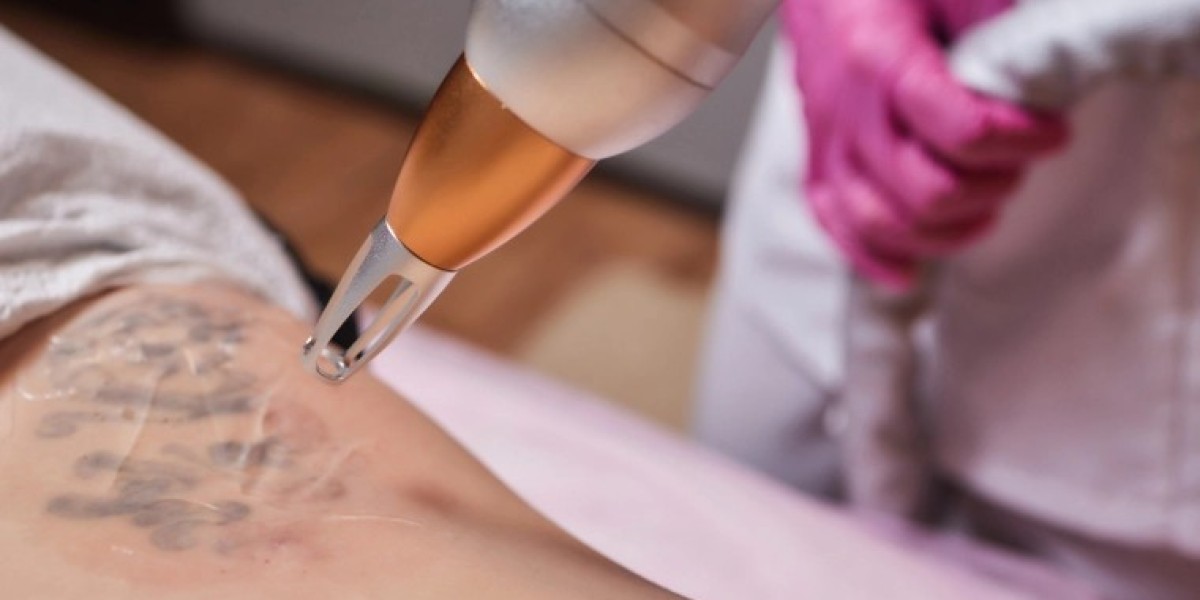 Top Reasons to Choose PicoSure for Laser Tattoo Removal