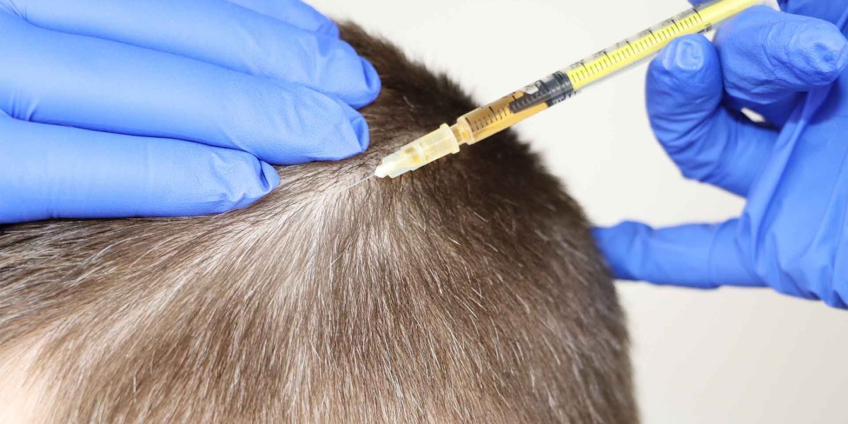 Is the Cheapest PRP Treatment Actually Worth It