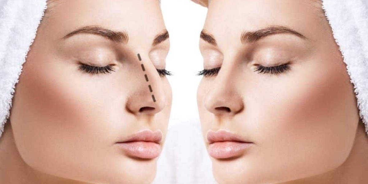 7 Reasons to Choose Rhinoplasty Surgery in Riyadh