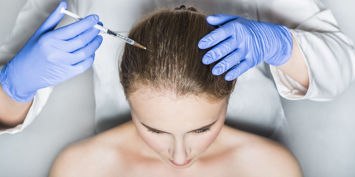 Are Hair Transplants Done By Specialists?