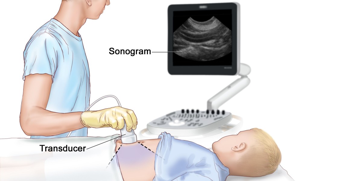 Nephroblastoma Treatment Market: Emerging Trends and Strategic Opportunities