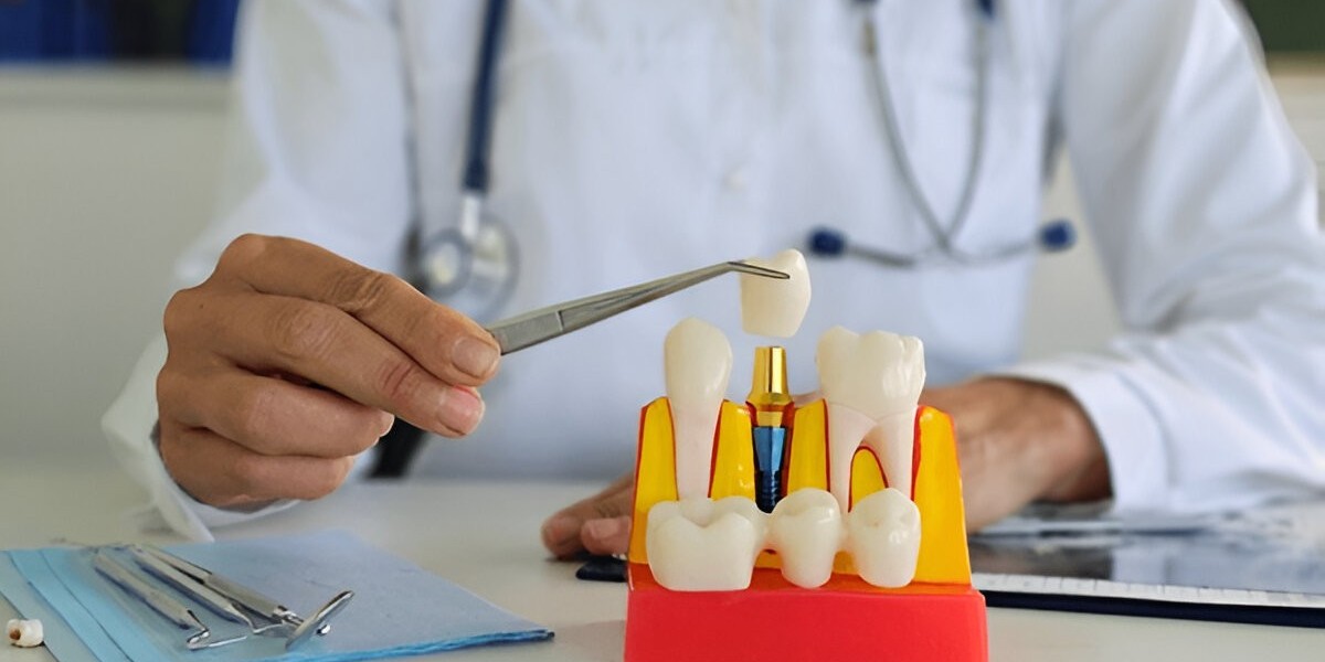 Denture Maintenance & Care in Kurukshetra and Crowns & Bridges Services in Kurukshetra – Sobti Nursing Home