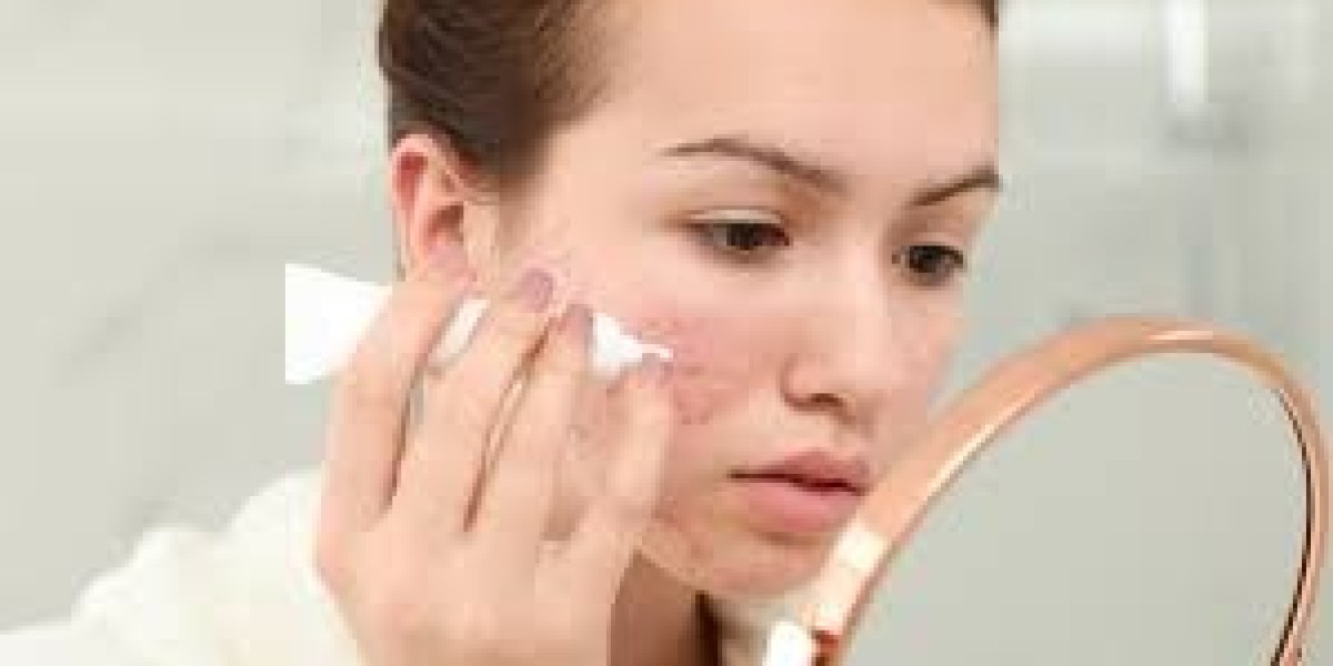Anti-Acne Cosmetics Market Opportunities Grow Amid Rising Global Demand for Targeted ,Multifunctional Skincare Product