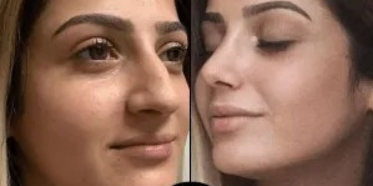 Beauty with a Boost: Why Aesthetic Clinics Are More Than Skin Deep