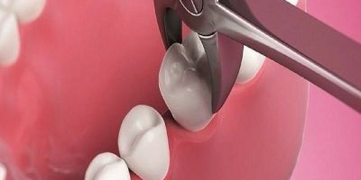 From Fear to Relief: How Dubai is Redefining Tooth Extraction