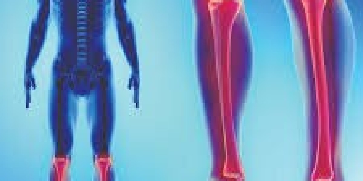 Limb Lengthening Surgery in Japan: Rising Demand, Advanced Techniques, and Market Insights