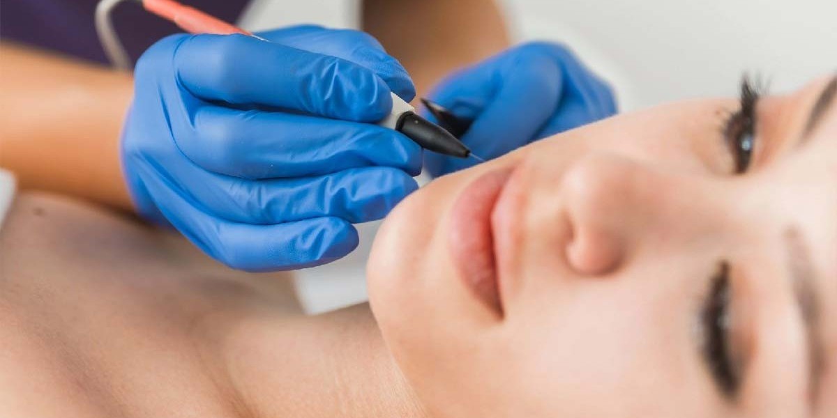 Electrolysis Hair Removal Cost: Top Factors That Influence Pricing