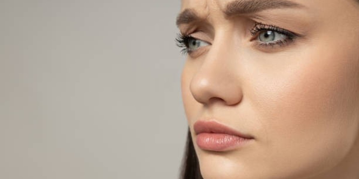 Confidence Starts with Contour – Alarplasty in Riyadh
