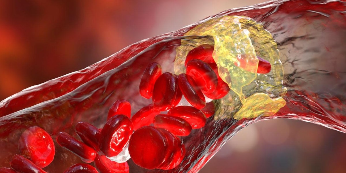 Atherosclerosis Drugs Market Forecast Suggests Major Growth in Asia-Pacific Due to Rapid Urbanization and Diet Shifts