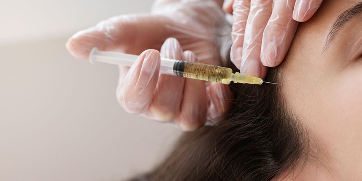 Can PRP Stop Hair Loss? Discover the Facts