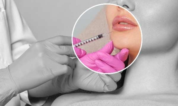 lip filler Ipswich