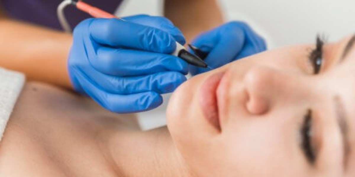 Who Benefits Most From Electrolysis Laser Hair Removal?