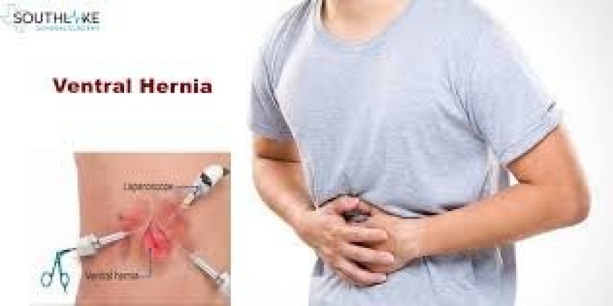 Global Ventral Hernia Treatment Market: Innovations Driving Growth and Patient Outcomes