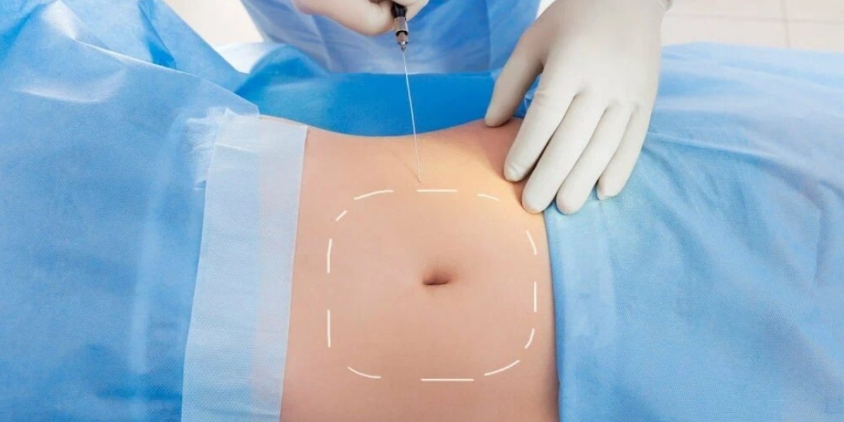 VASER Liposuction for Double Chin Removal in Riyadh