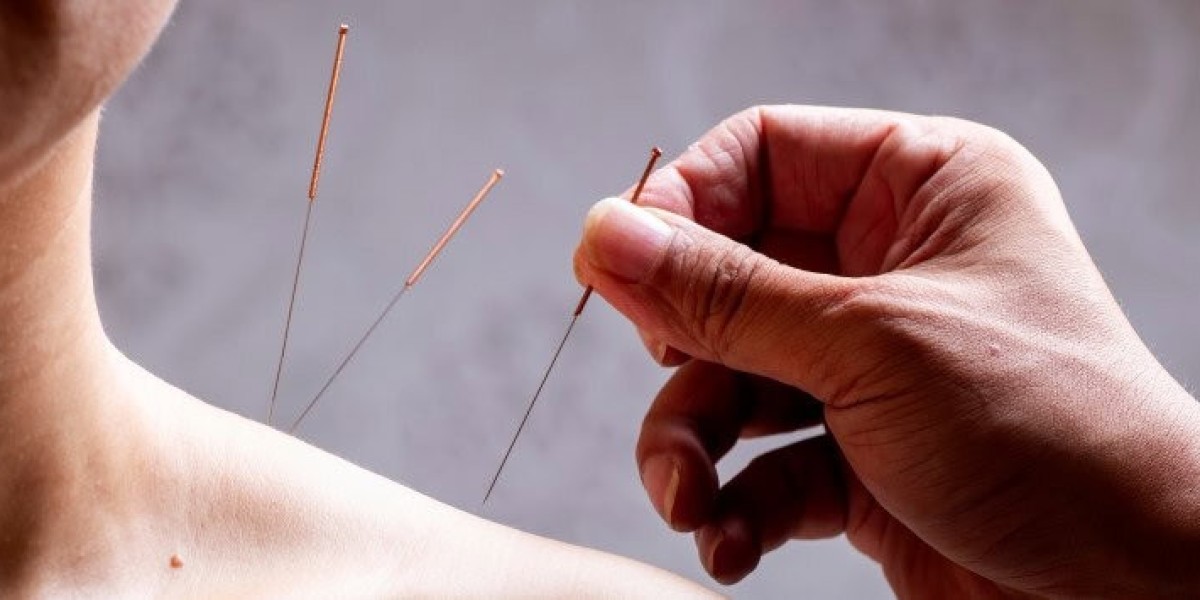 What Is Acupuncture and How Does It Work?