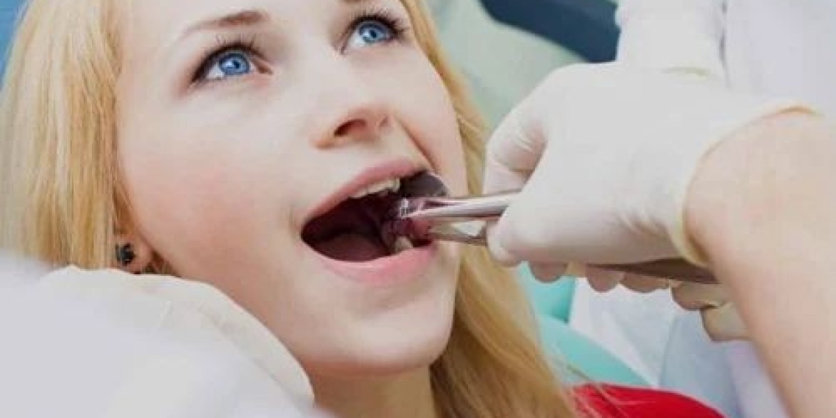 New Tech Alert: Dubai’s High-Tech Approach to Tooth Removal
