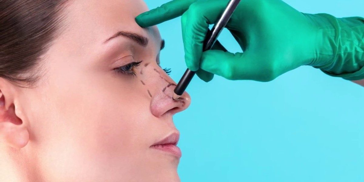 How to Prepare for Rhinoplasty Surgery in Riyadh