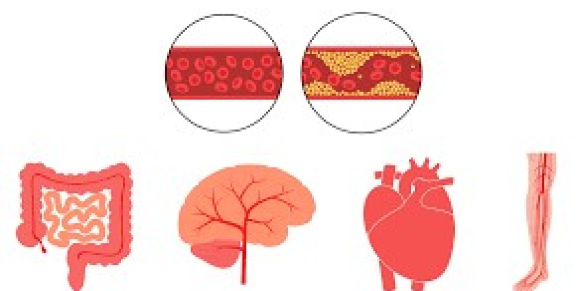 Ischemia Reperfusion Injury Market: Trends, Growth, and Future Outlook