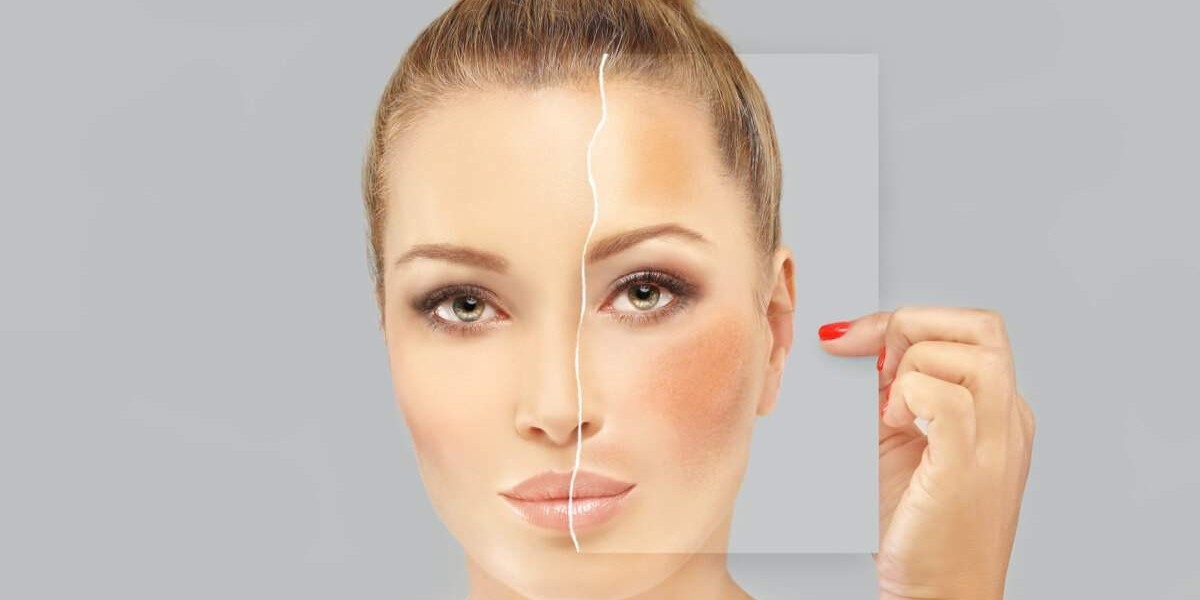 Glycolic Acid Peel Market: Analyzing Growth, Key Trends, Drivers, and Future Insights