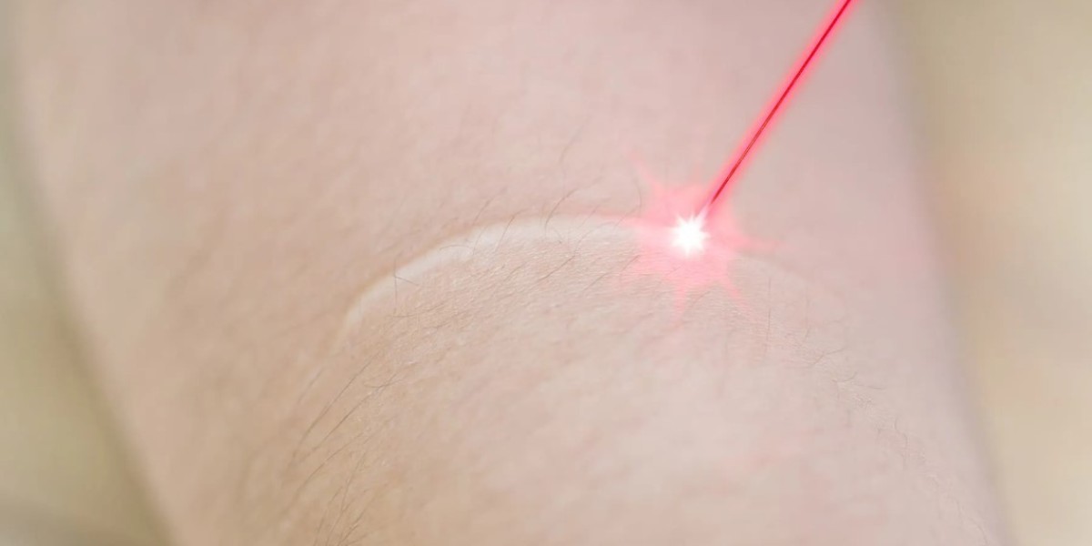 Best Offers on Laser Scar Removal in Riyadh This Month