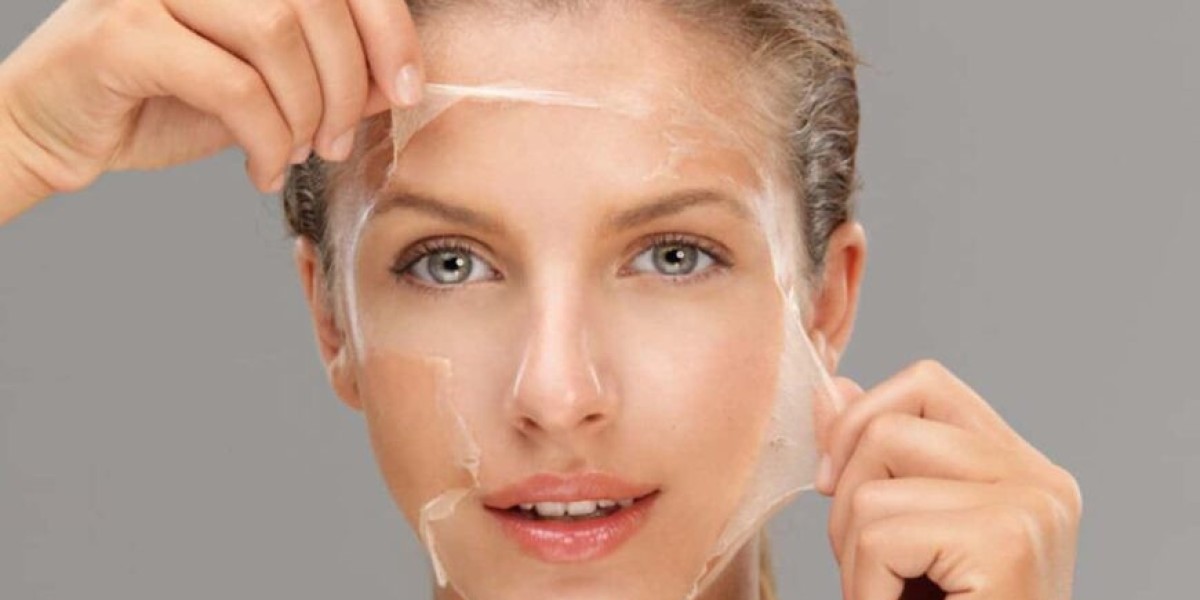 Which Is Better, Carbon Laser or Chemical Peeling for Glow-Up