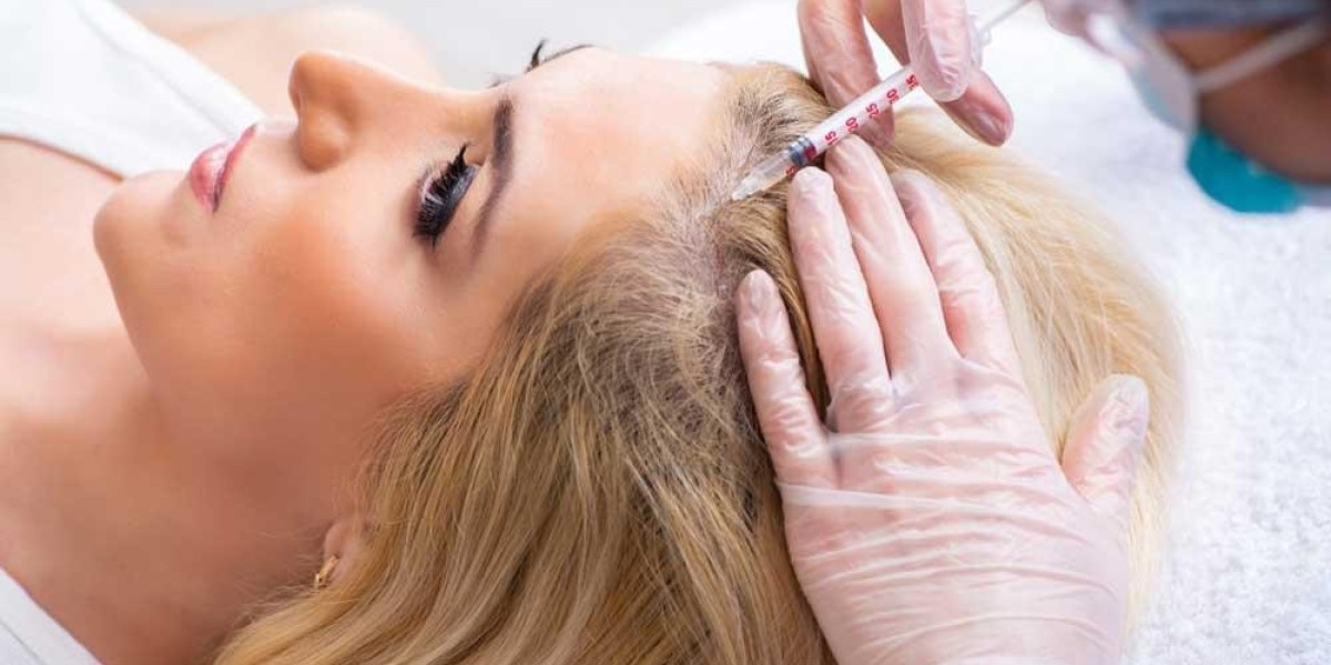How to Tackle Hair Loss in Harsh Weather