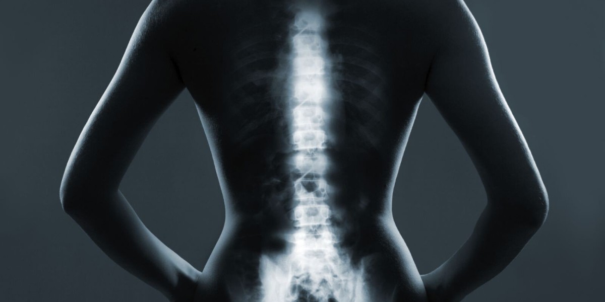 Targeted Therapies and Biomarkers: Key Trends in the Metastatic Bone Cancer Market