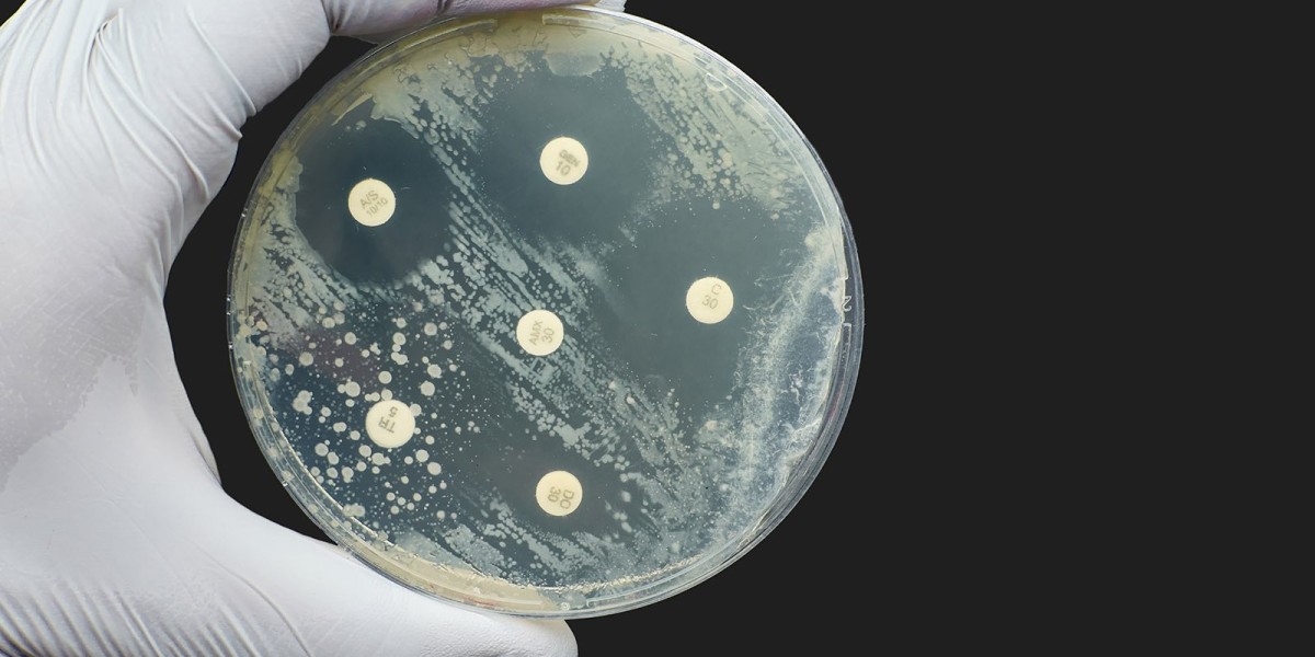 Antimicrobial Susceptibility Test Market Forecast: Projected Growth Driven by Increasing Infectious Diseases and Diagnos