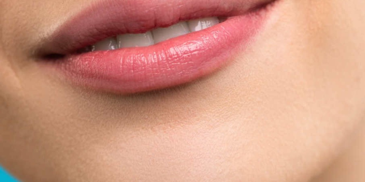 Lip Augmentation and Teeth Whitening: Smile Makeover