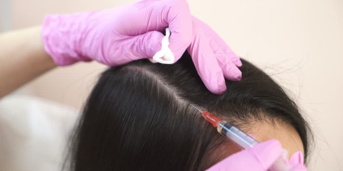 PRP Hair Treatment for Thinning Hair: Is It Worth It?