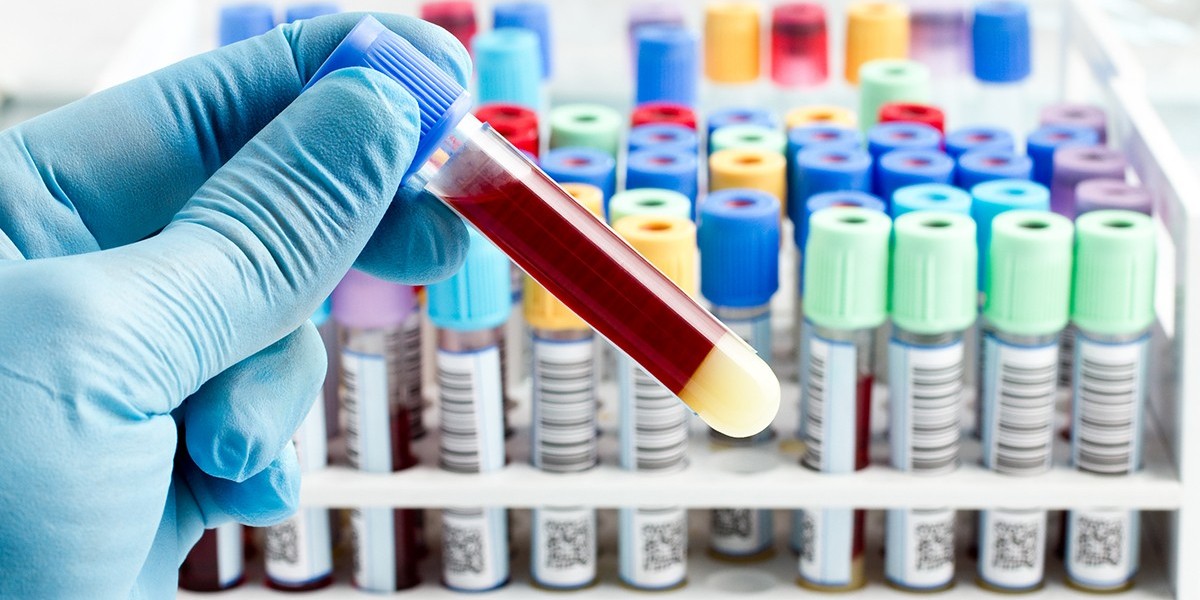 How Blood Test at Home in Dubai Helps Track Vital Health Metrics