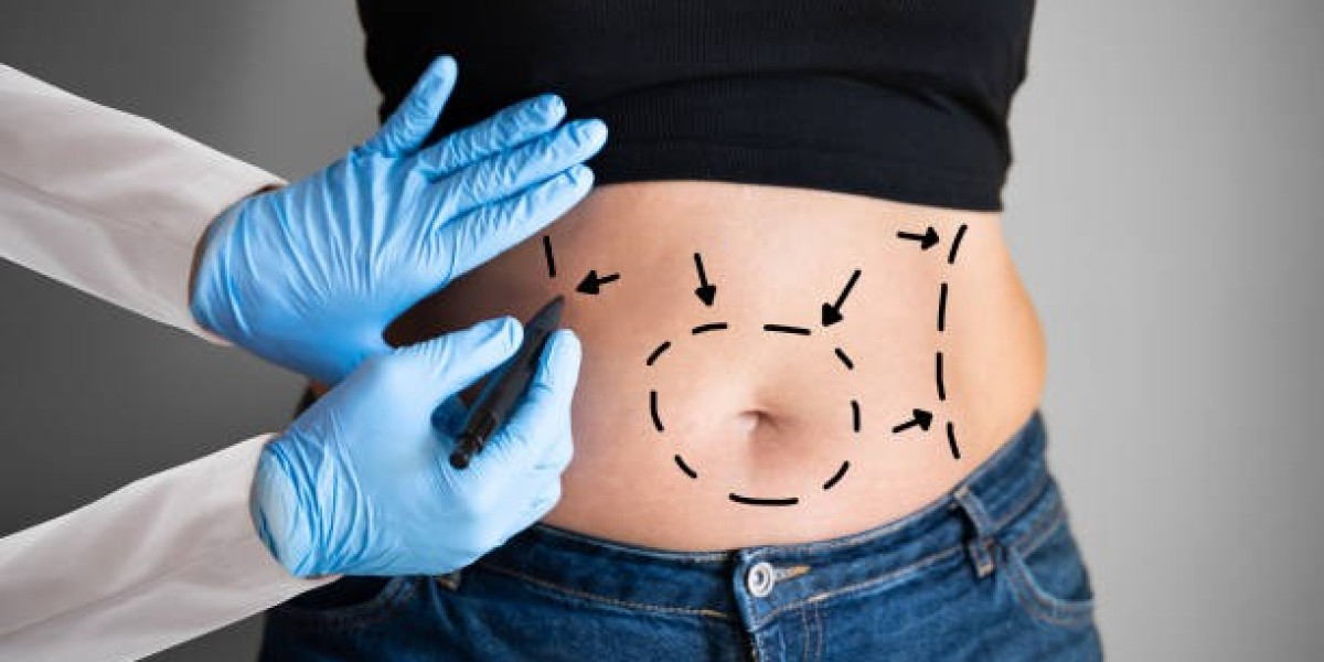 Obesity Surgery in Riyadh: Patient Success Stories