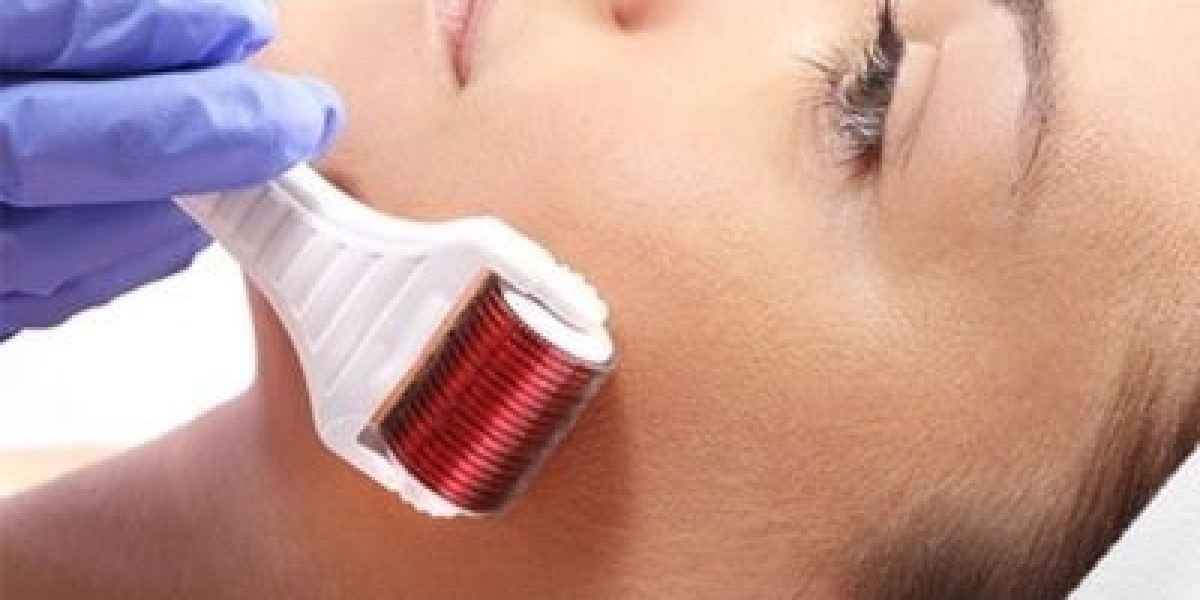 Benefits of Derma Roller Treatment for Skin Rejuvenation