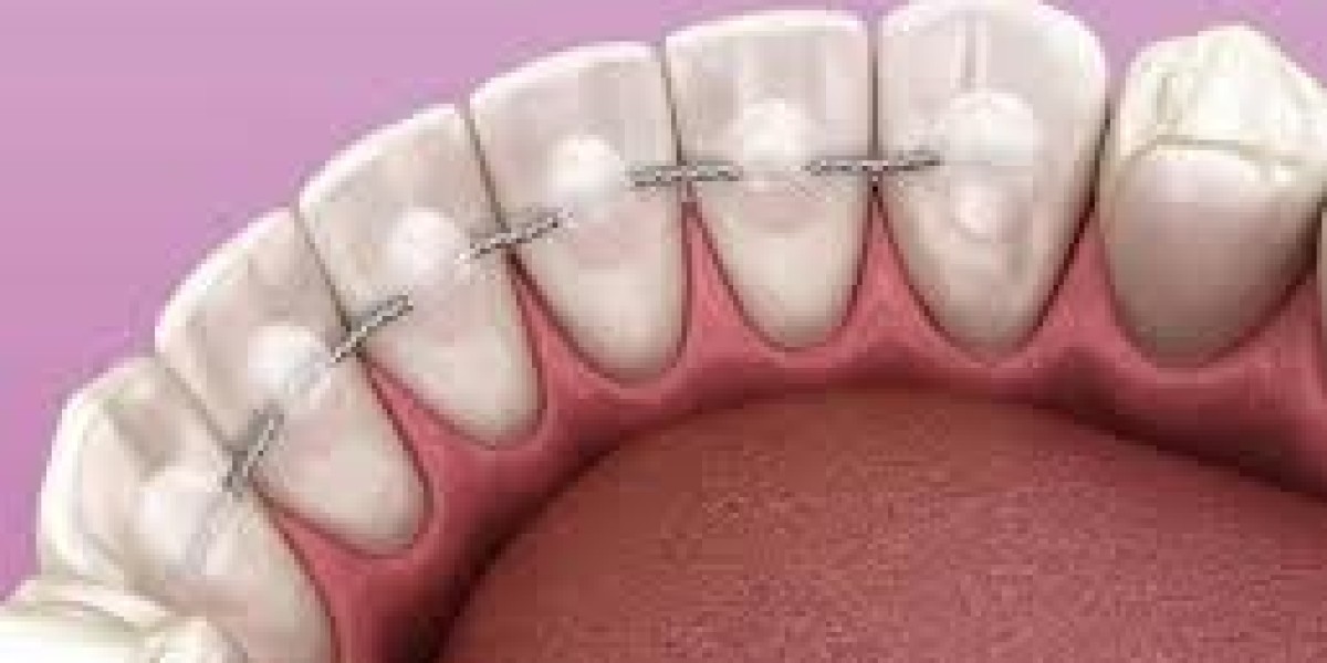 Orthodontic Retainers Market: Challenges, Opportunities, and Forecast Scenarios Shaping the Next Decade