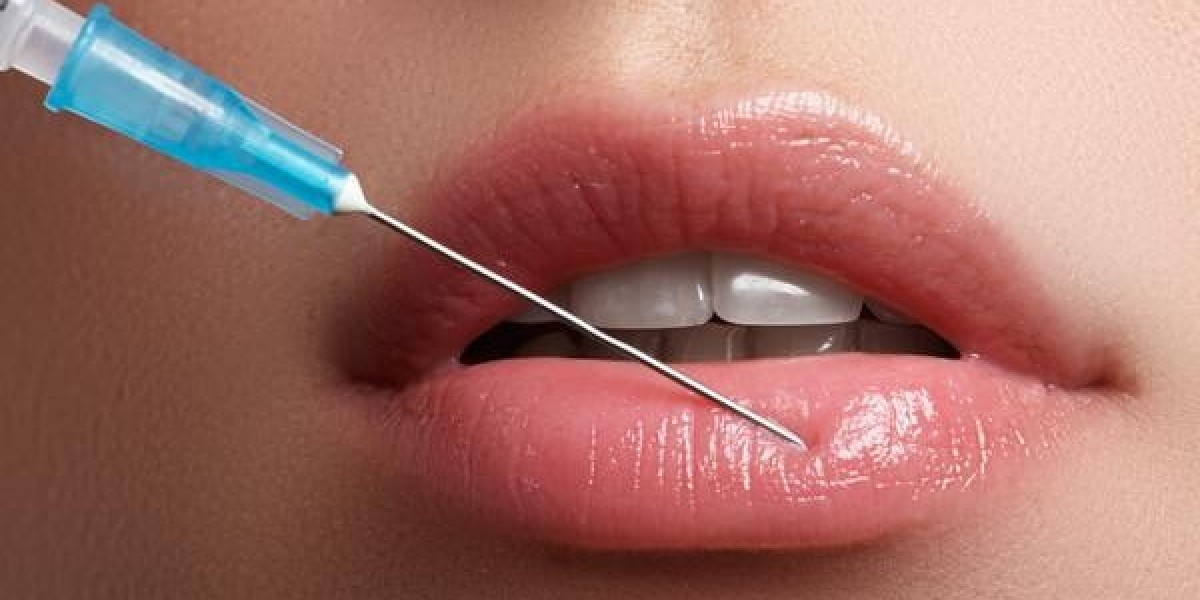 Lip Filler Market Dynamics and Consumer Preferences Influencing Global Aesthetic Industry Landscape