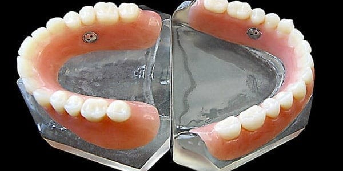 The Future of Dentures: 3D Printing and Smart Materials