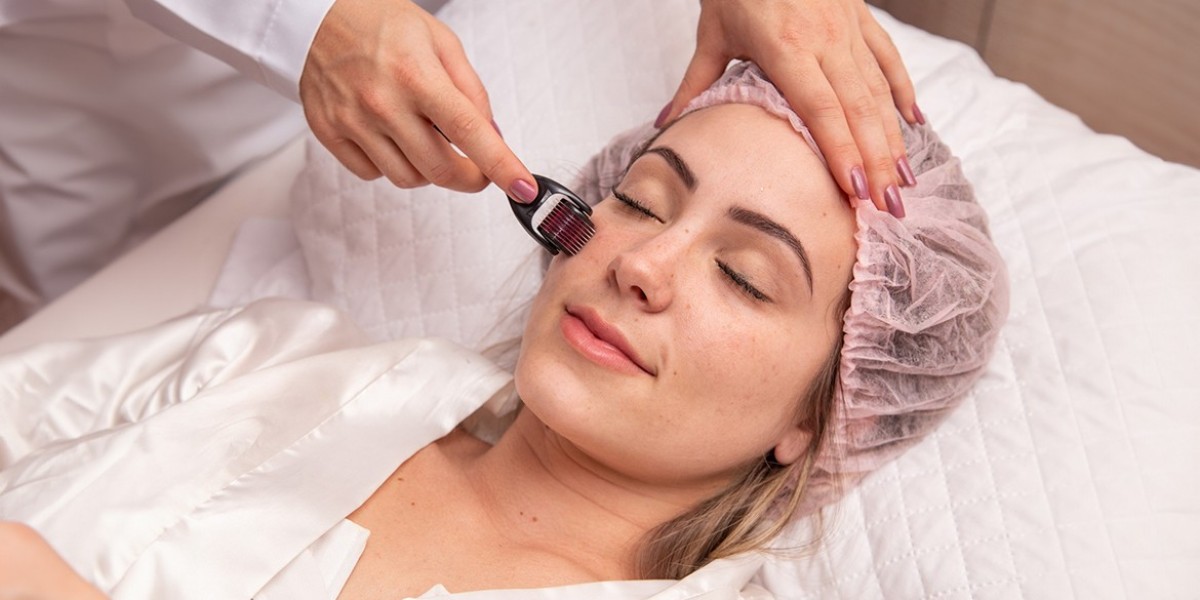 Mesotherapy Treatment for Quick Facial Rejuvenation: The Secret to Radiant Skin