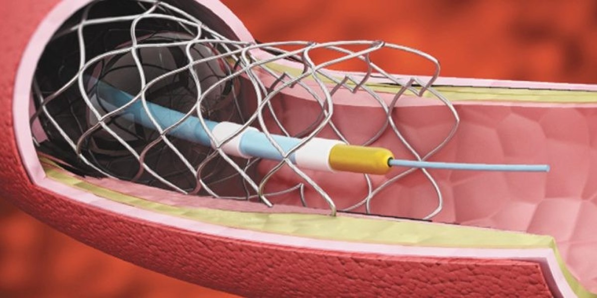 Angioplasty Balloons Market Demand: Rising Need for Effective Treatment Options in Peripheral Artery Disease Management