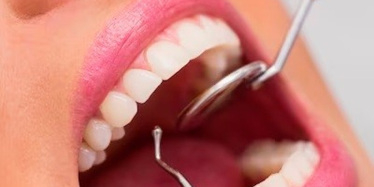 Step-by-Step Guide to the Root Canal Procedure