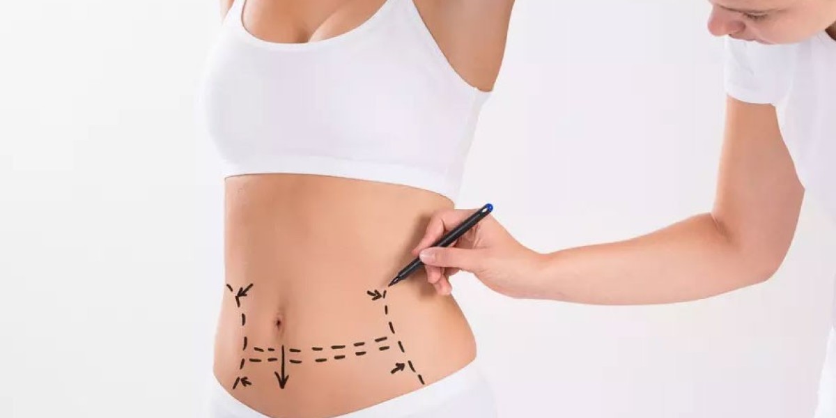 Why Dubai Is a Global Hotspot for Liposuction Surgery