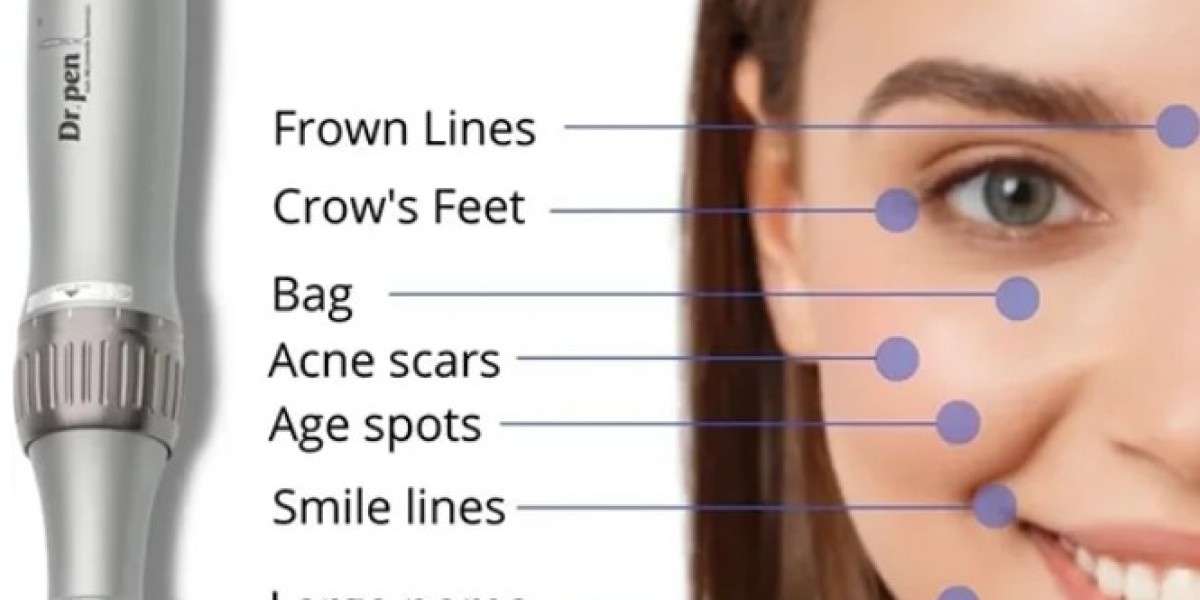 So oft sollten Sie Microneedling mit 1 mm Nadeln durchführen