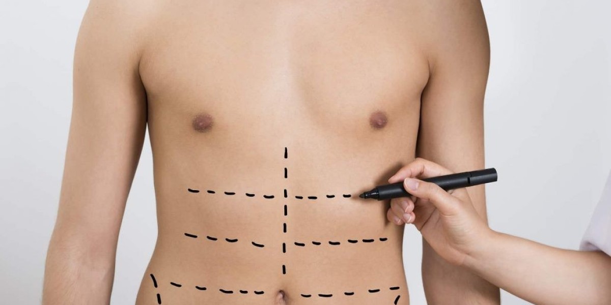 Liposuction in Dubai: Sculpt Your Shape Without the Wait