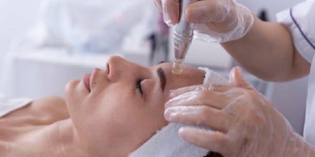 ديرما بن: الحل الطبيعي لبشرة مثالية
