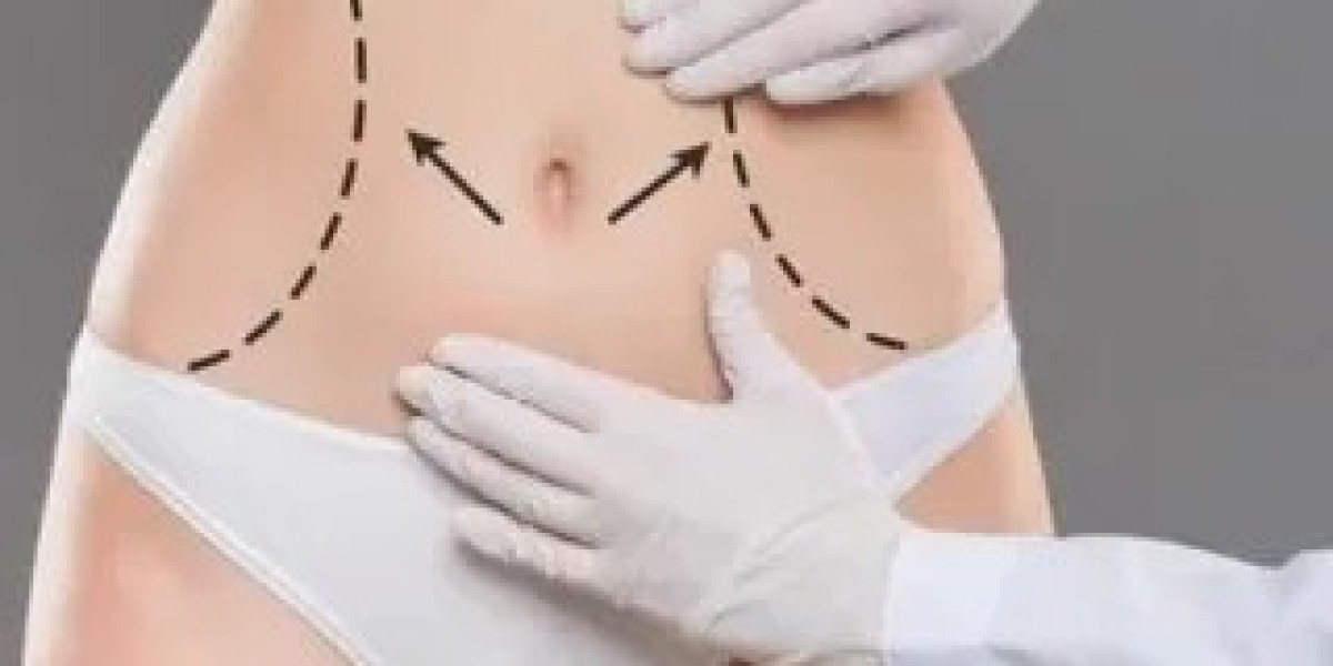 Tummy Tuck and Skin Tightening Options in Islamabad